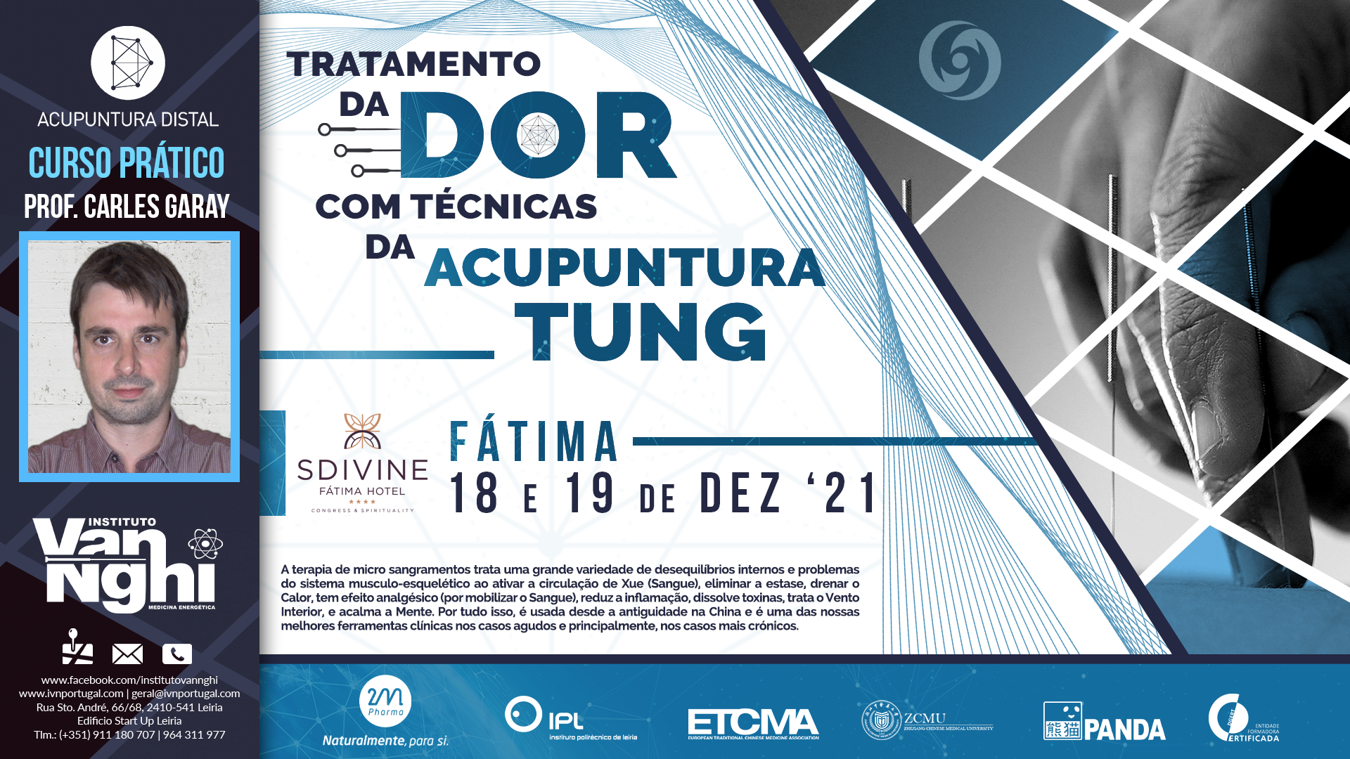 FORMAÇÃO - Tratamento da Dor com Técnicas da Acupuntura Tung