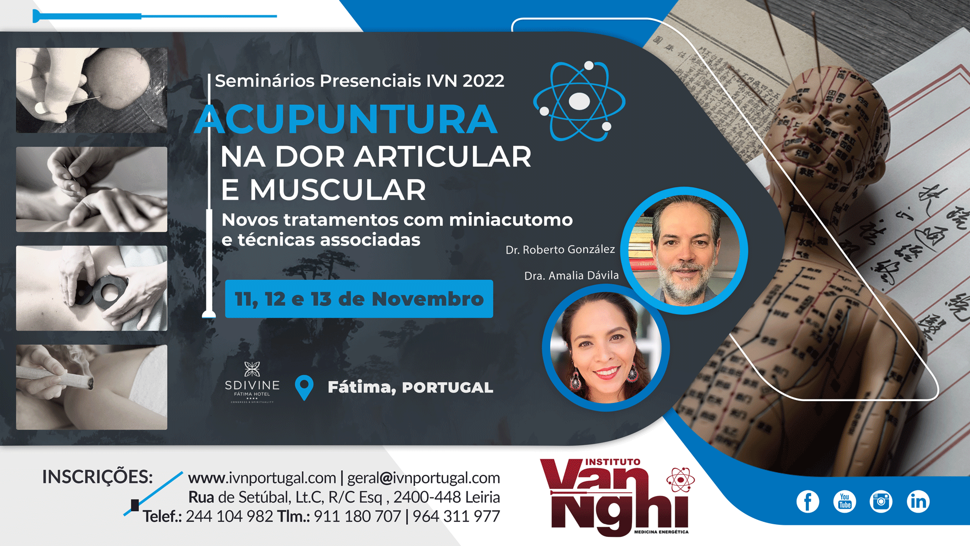 Acupuntura na Dor Articular e Muscular
